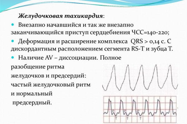 Megaruzxpnew4af union в обход блокировки